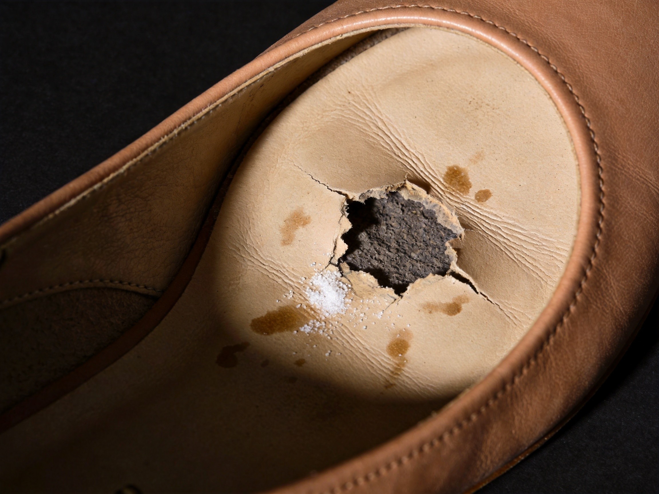 Why Your Shoes Develop a Hole in the Ball-of-Foot Insole After Only a Few Months of Wear — The Hidden Foam-Density Compression Set, Sweat-Electrolyte PU Hydrolysis, and Metatarsal-Pad Pressure-Concentration Mechanics Behind the 2026 'My Shoe Insole Wore Through at the Ball of My Foot' Epidemic